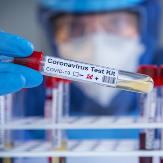 Rusvai Miklós szerint fokozódni fog a Covid-járvány, az illetékesek hallgatnak