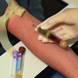 A nemzeti laboroktól is visszalépett a kormány